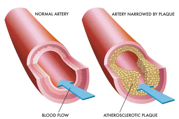 poor blood flow symptoms